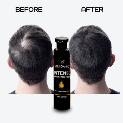 Intense Hair Growth Oil | Say Goodbye to Hair Fall